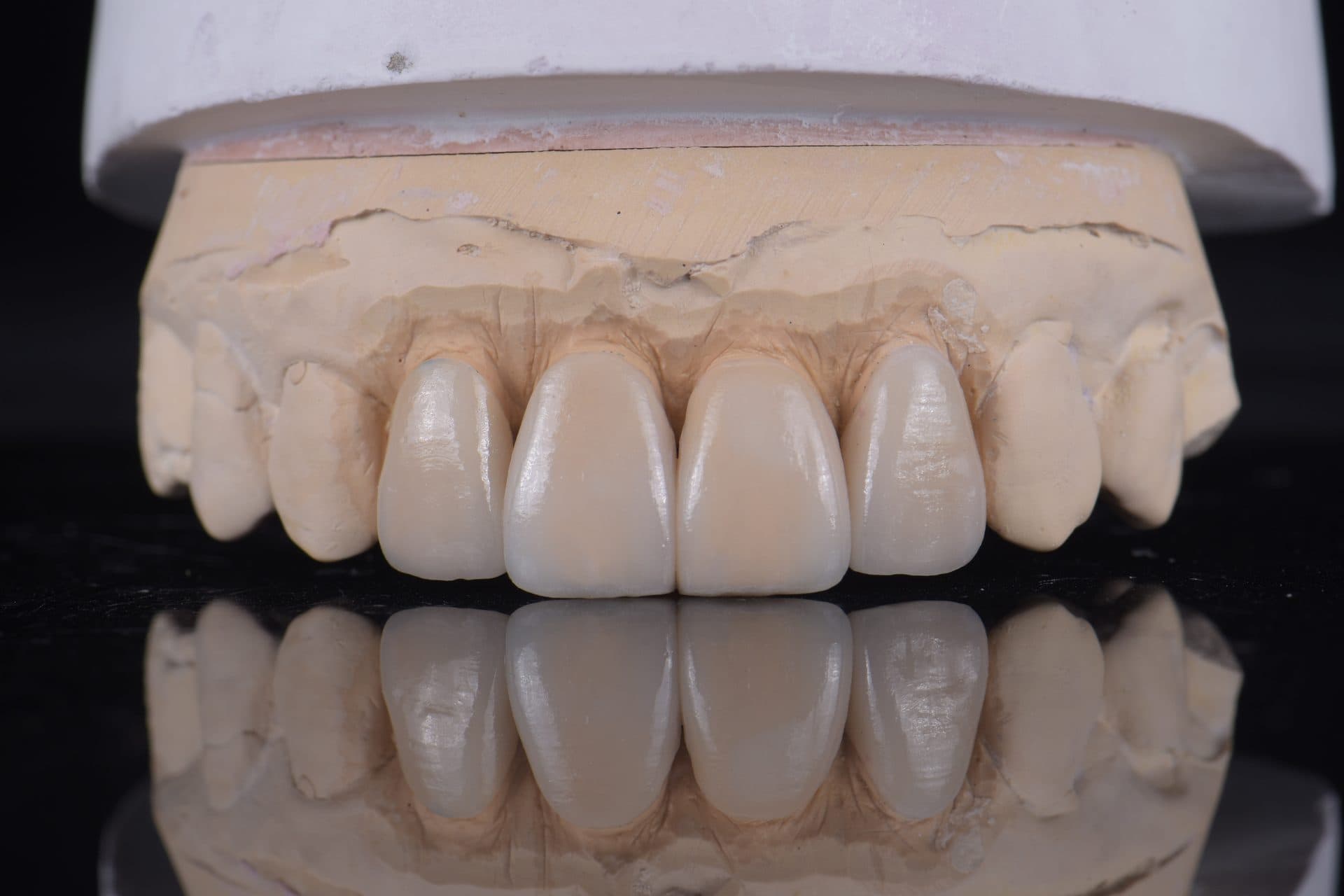 เซรามิกอัดขึ้นรูป IPS e.max / Empress — 7