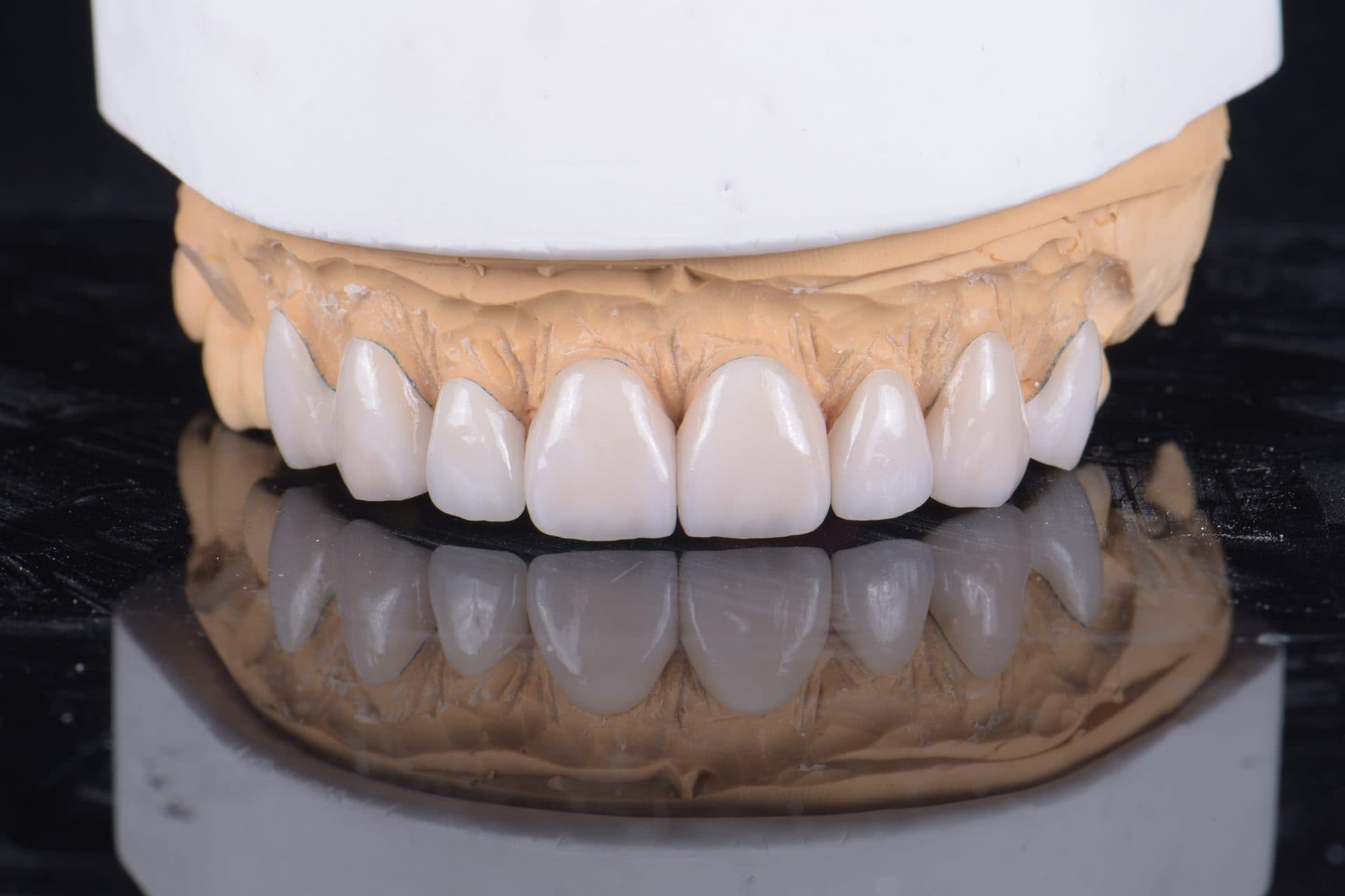 เซรามิกอัดขึ้นรูป IPS e.max / Empress — 13