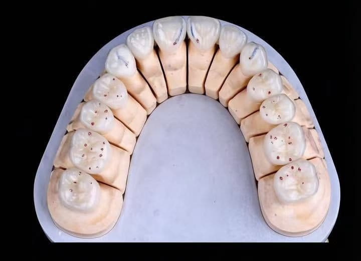 ครอบฟันเซอร์โคเนีย UPCERA (Cibeijian / Jade Porcelain) — 2