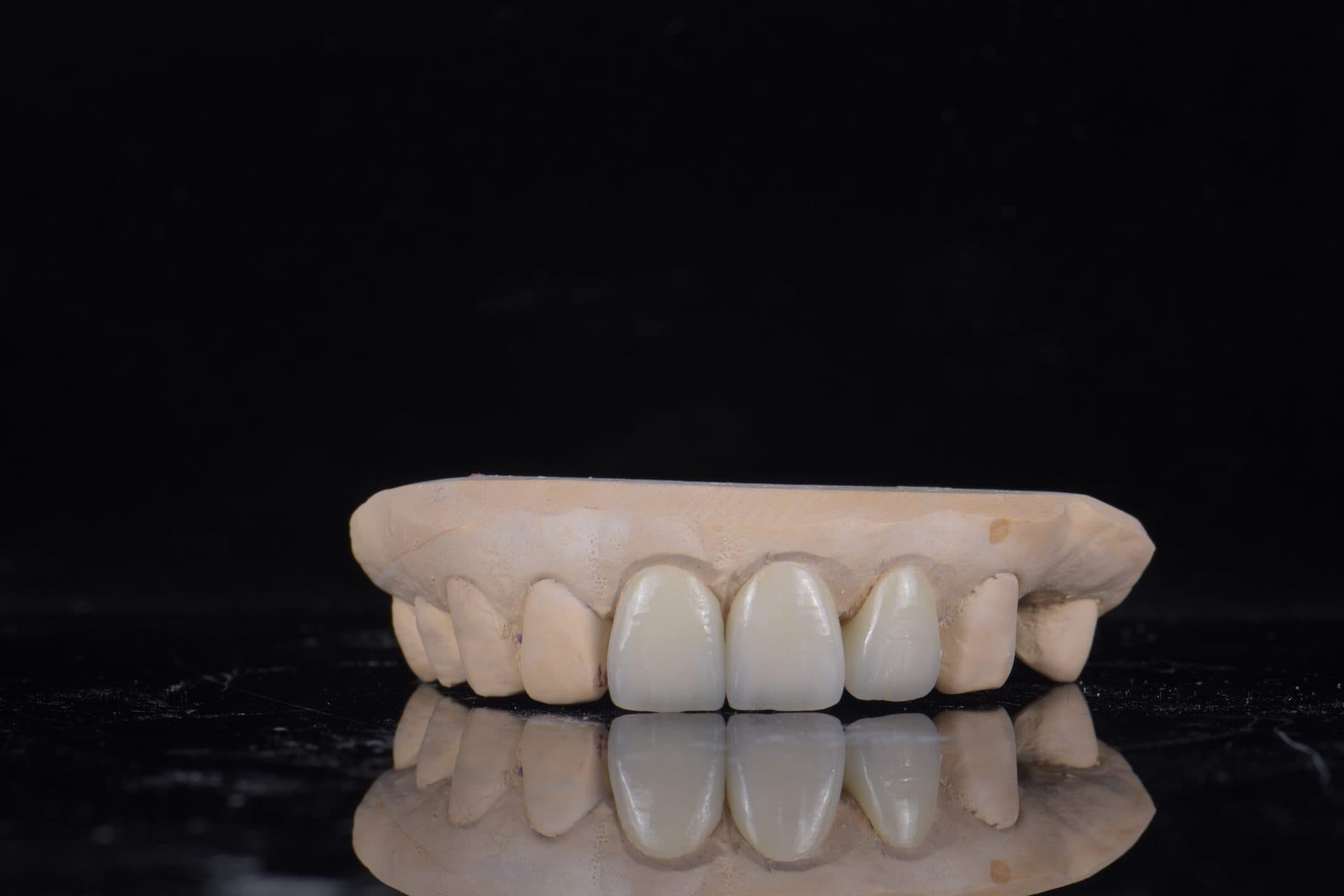 ครอบฟันเซอร์โคเนีย UPCERA (Cibeijian / Jade Porcelain) — 10