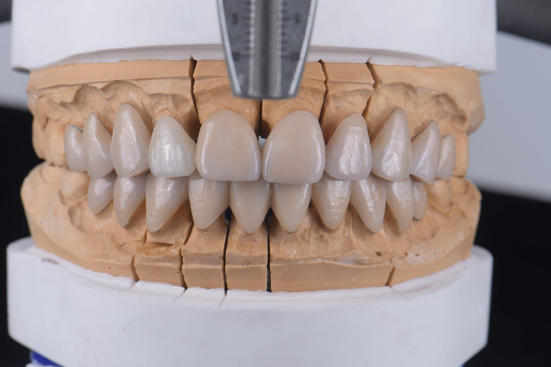 ครอบฟันคอมโพสิตเซรามิก VITA 3D — 3